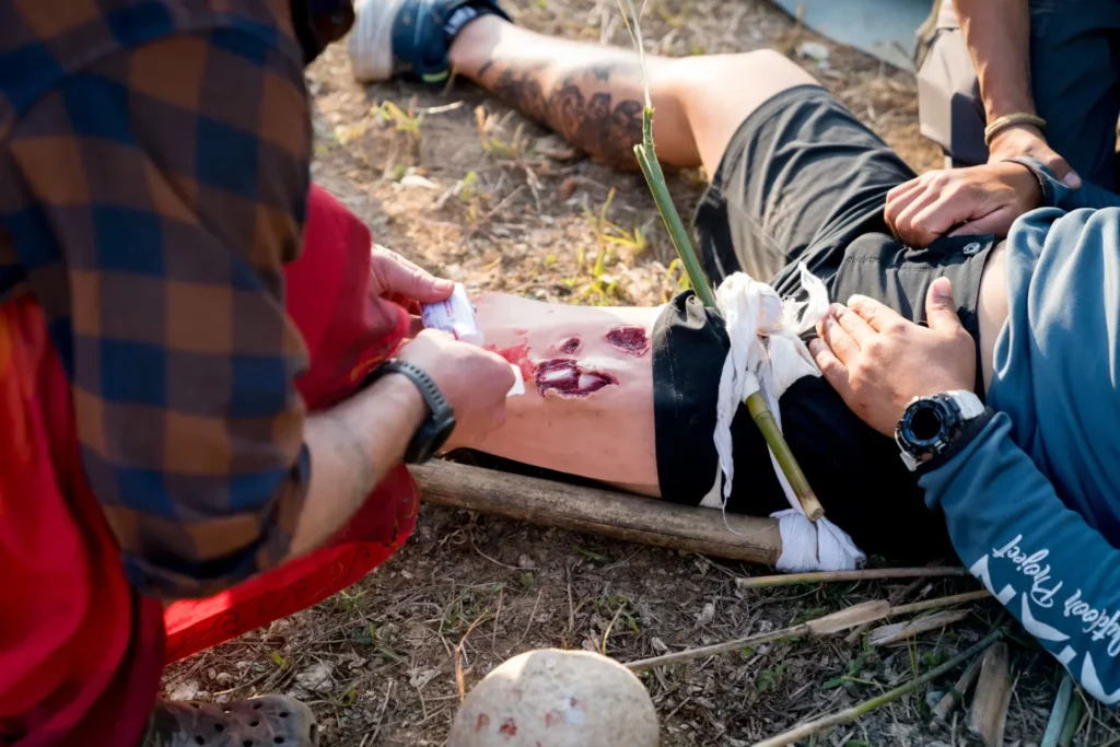 Legal Help for Bone Fractures After Accidents a man laying on ground