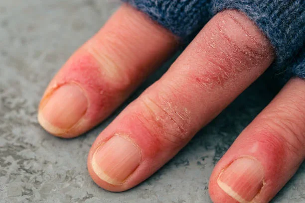 Fashion That Works at -30°F: Tested by Alaskans frostbite