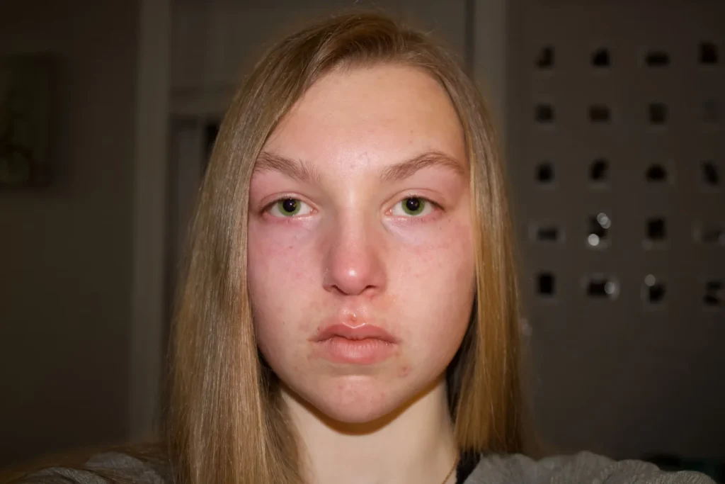 Practical Tips to Know Before Getting a Facelift A girl taking selfie