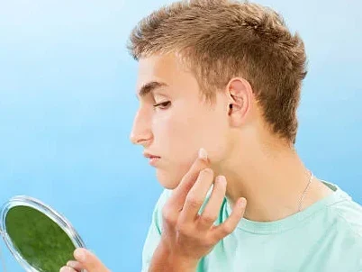 Say Bye to Mosquito Bite Itches With Hydrocolloid Patches man applying patch on his face